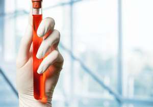 泰國醫(yī)院試管成功率高不高