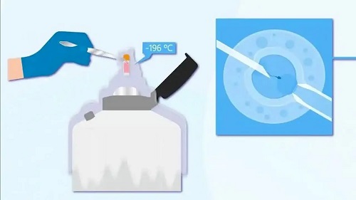 做一次試管嬰兒錢(qián)需要多少