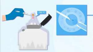 做一次試管嬰兒錢(qián)需要多少