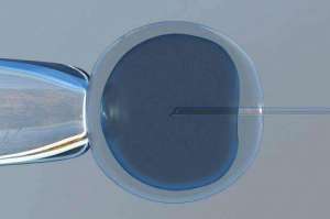 赴美試管嬰兒費(fèi)用預(yù)算