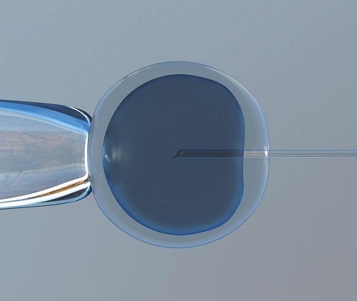 試管嬰兒費(fèi)用大概要多少錢