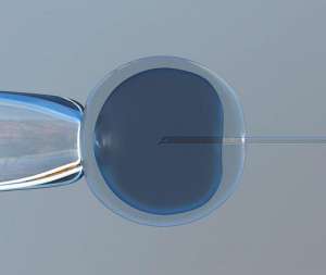 試管嬰兒費用大概要多少錢