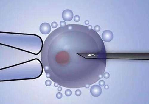 在美國做試管嬰兒需要多少錢?