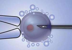 在美國做試管嬰兒需要多少錢?