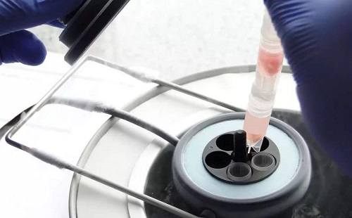 做試管嬰兒的費(fèi)用