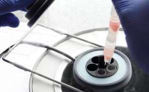 為什么選擇俄羅斯試管嬰兒