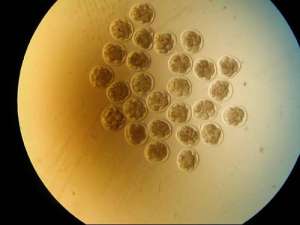 為什么做泰國(guó)試管嬰兒還需要檢查費(fèi)用