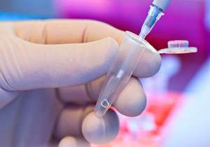 現(xiàn)在做試管嬰兒的全部費(fèi)用要多少錢