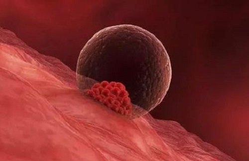 去泰國(guó)做試管要準(zhǔn)備多少錢(qián)